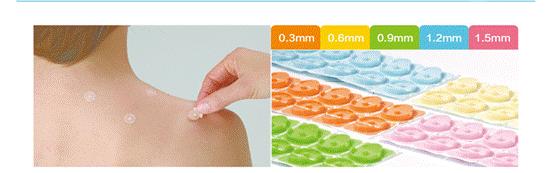 确认过眼神，我遇上对的人——当顽固性呃逆遇上揿针疗法