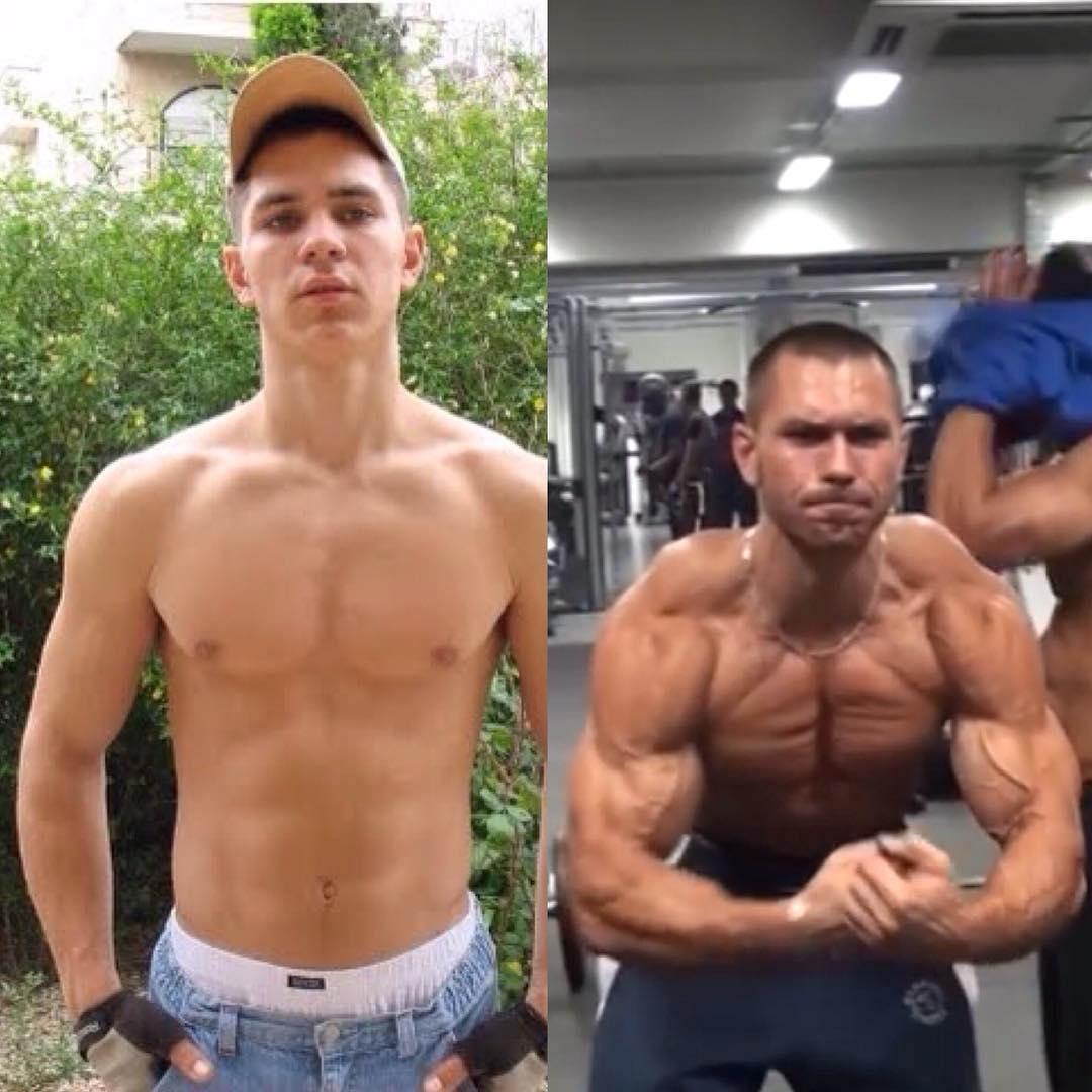 激痛点是筋膜炎吗,肌肉痉挛硬结怎么消除