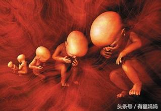 不良妊娠备孕成功案例,多胎妊娠解决办法