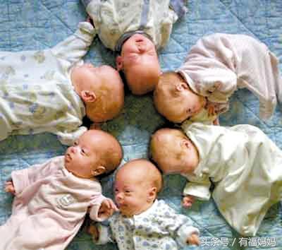 不良妊娠备孕成功案例,多胎妊娠解决办法