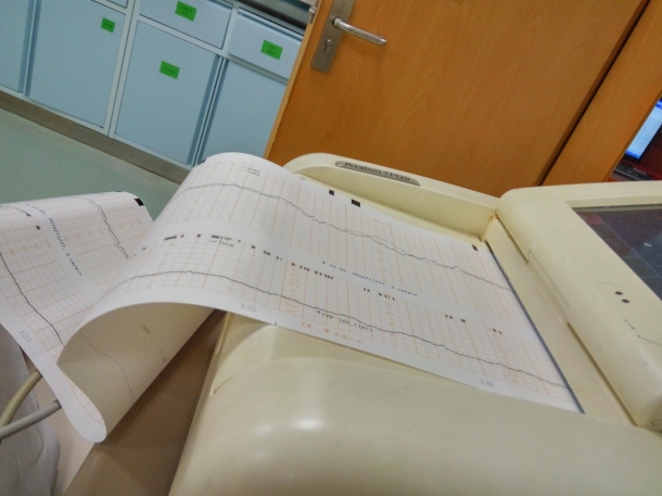 孕期胎心比较弱如何养护,胎心监护有时候异常怎么回事