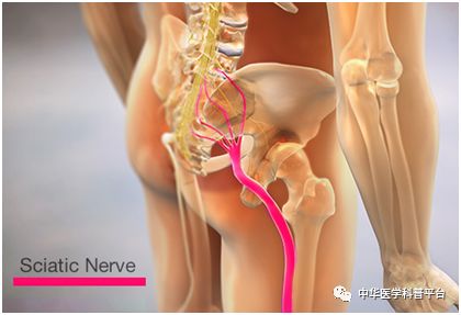 腘窝处疼痛的常见原因,一招教你解决各种疼痛