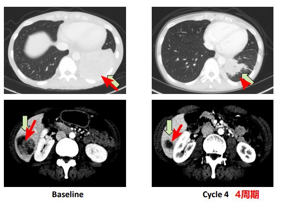 神奇制药抗癌专利,神奇制药抗癌药取得突破