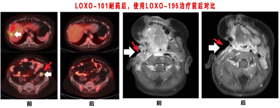 神奇制药抗癌专利,神奇制药抗癌药取得突破