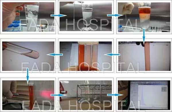 介入治疗癌症的最新方法,血管介入治疗癌症效果怎么样