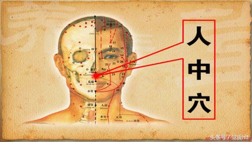 夏季中暑解决最快的方法,夏季中暑急救用品