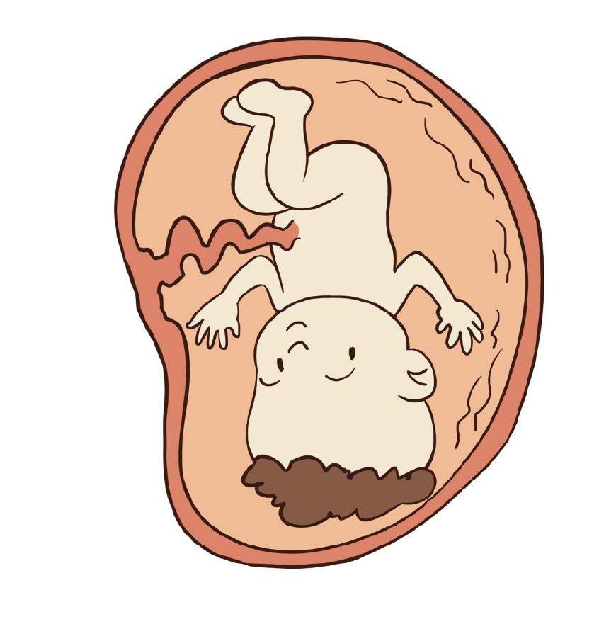 三维和四维彩超有哪些区别,孕中期三维和四维彩超都需要做吗