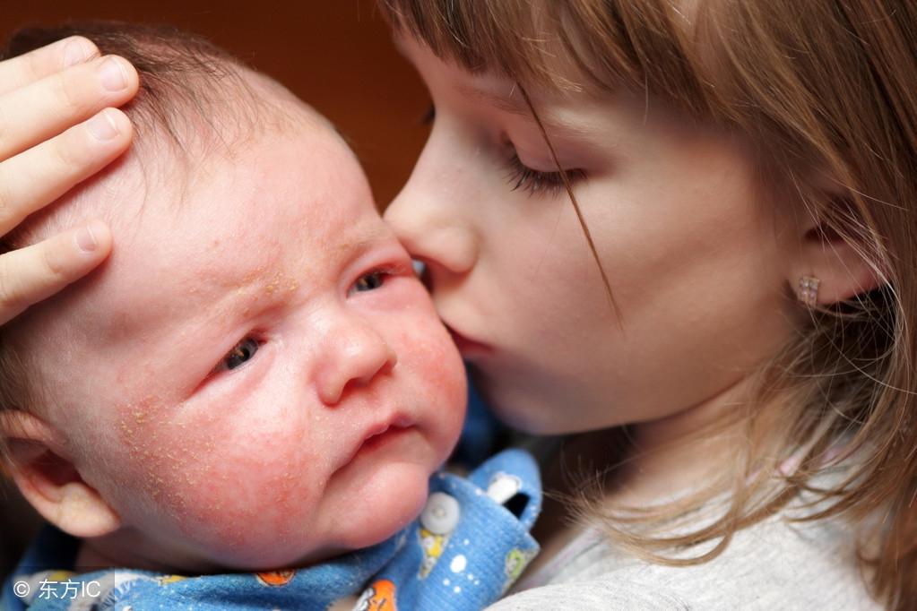 宝宝患了湿疹怎么办,宝宝有湿疹怎么处理最有效