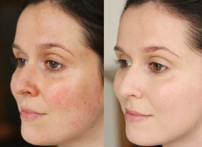 什么便宜的粉底液适合皮肤不好的,不到百元的大牌粉底液是正品嘛