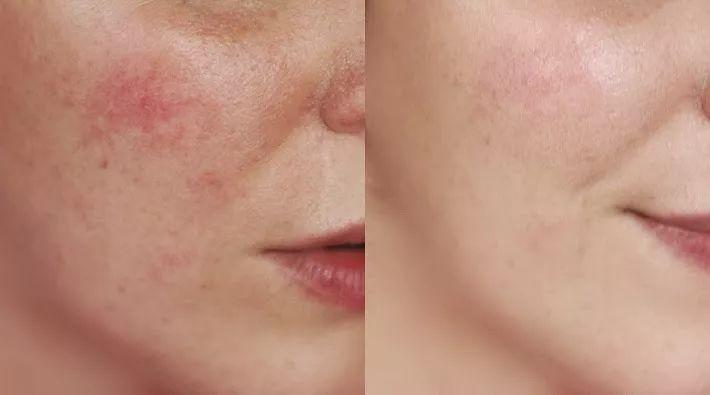 什么便宜的粉底液适合皮肤不好的,不到百元的大牌粉底液是正品嘛