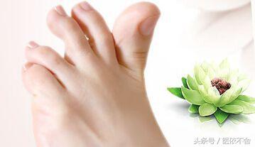 脚气在日常生活中注意什么,脚气老不好是什么原因引起的