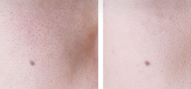 乐敦cc可以淡斑吗,日本乐敦cc美白淡斑