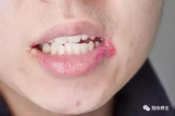 湿气重内火旺盛喝什么茶,内火大湿气重喝哪种茶