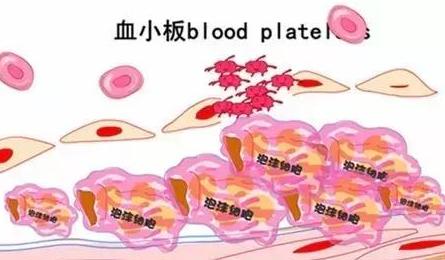 谢别录看血液病怎么样,血小板减少的小红点儿是什么样的