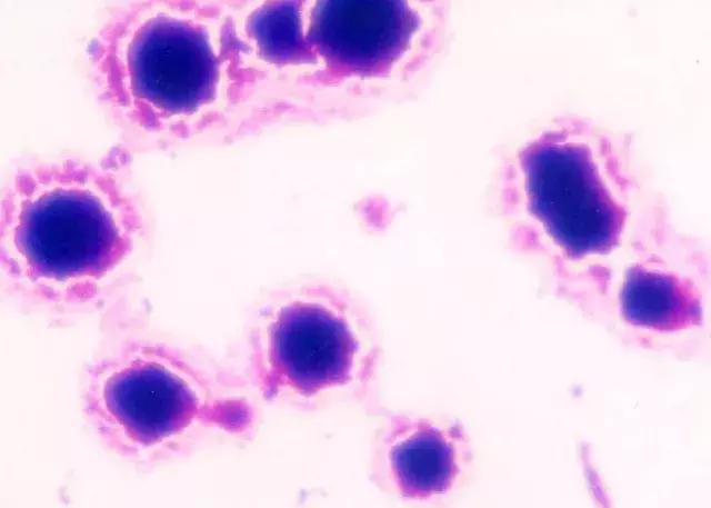 感染了支原体为什么容易不孕不育,支原体衣原体会不孕不育能治吗