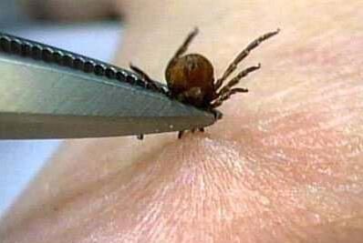 被这些小虫咬伤应该怎么办?天热如何预防虫咬?