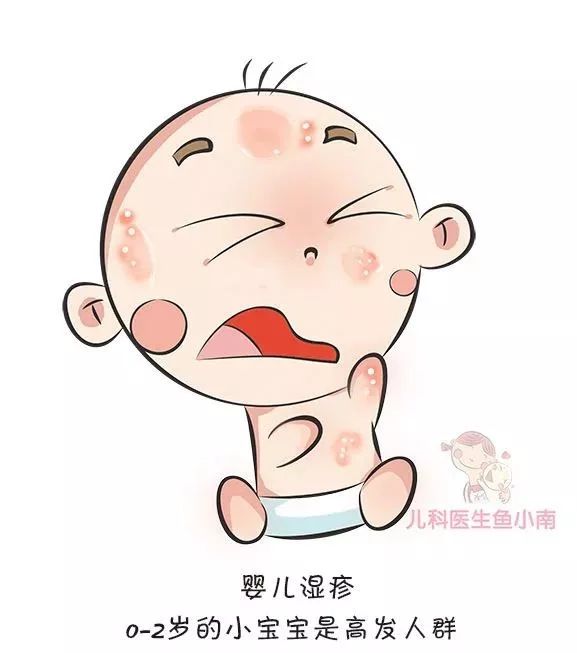 宝宝湿疹和痱子傻傻分不清,宝宝怎么辨别湿疹和红疹