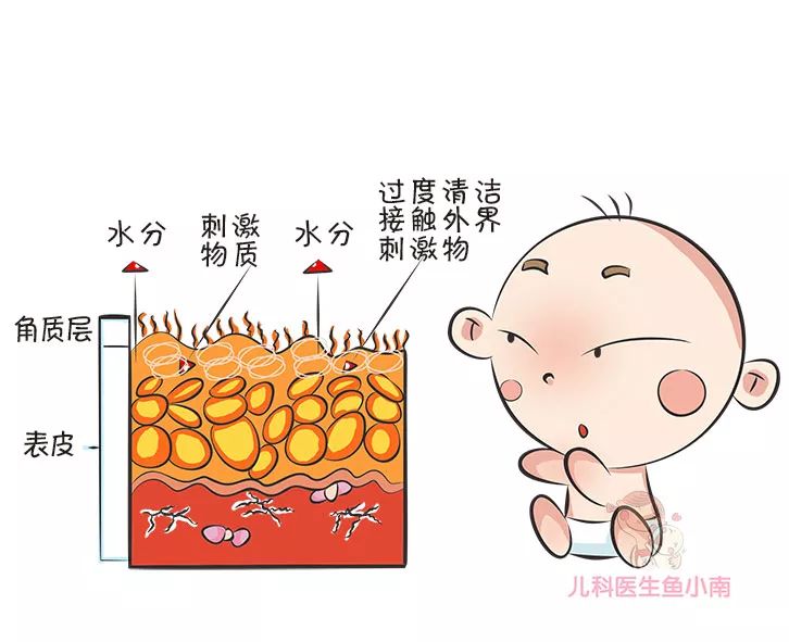 宝宝湿疹和痱子傻傻分不清,宝宝怎么辨别湿疹和红疹