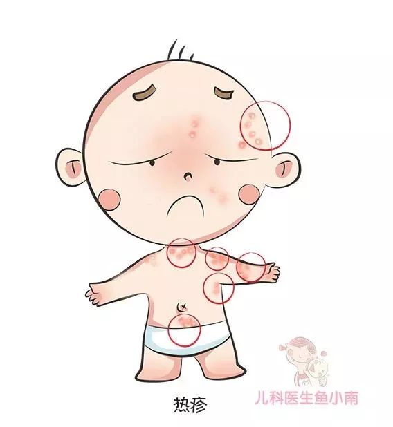 宝宝湿疹和痱子傻傻分不清,宝宝怎么辨别湿疹和红疹
