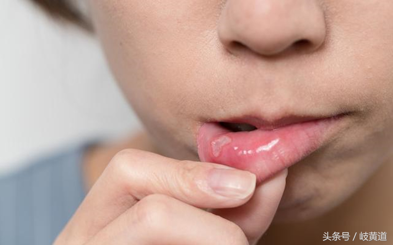 男子因“丝绸之路病”身上多处发生反复性溃疡，这到底什么病？