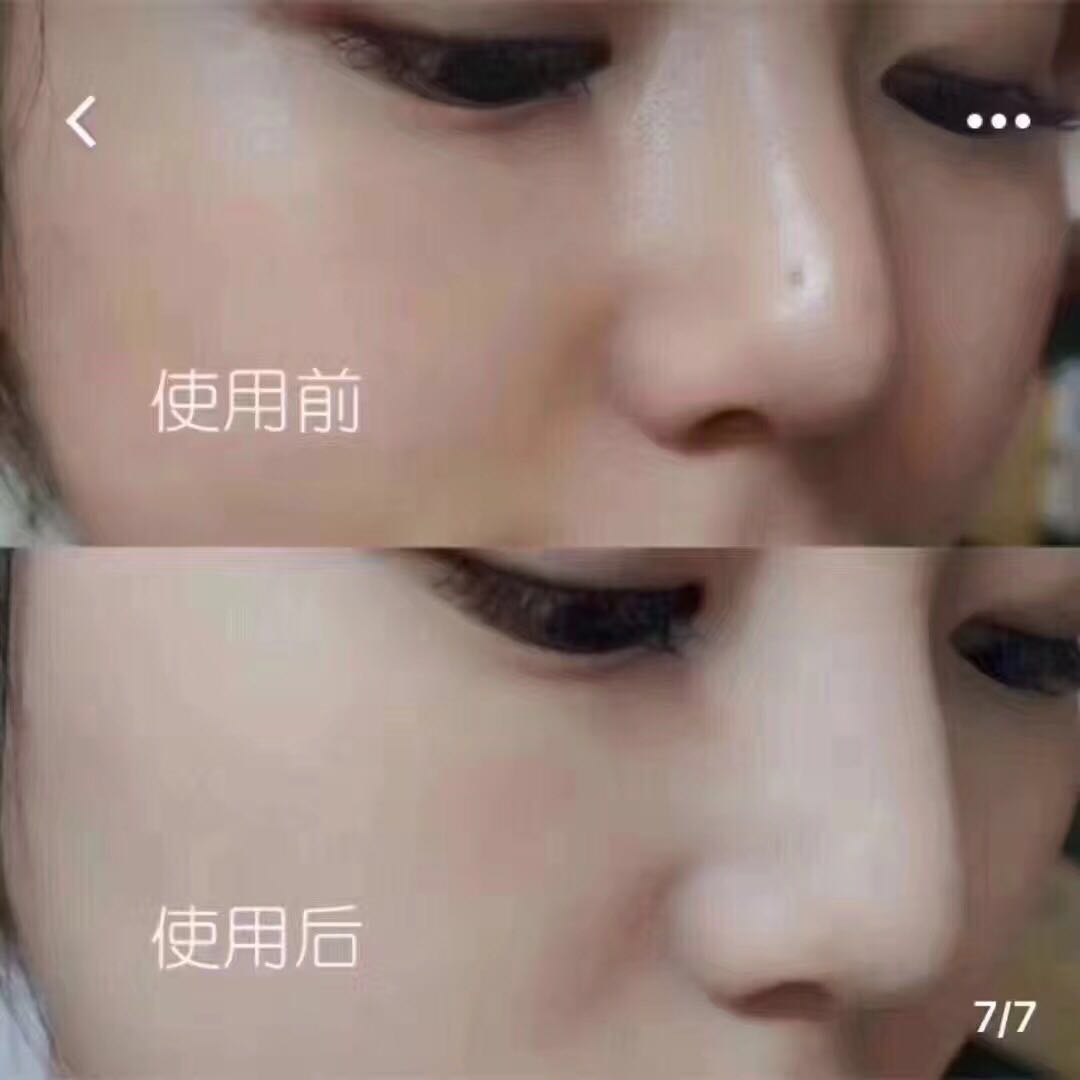 最新日本平价彩妆新品,日本最好的平价祛斑霜