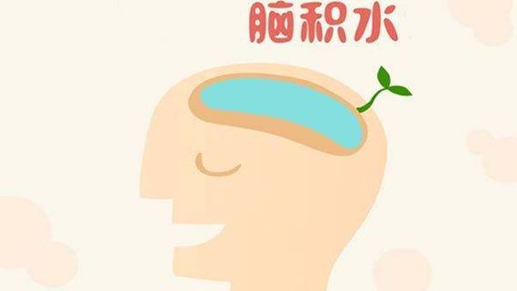 孕妈要知道的事情——怎么预防胎儿脑积水？