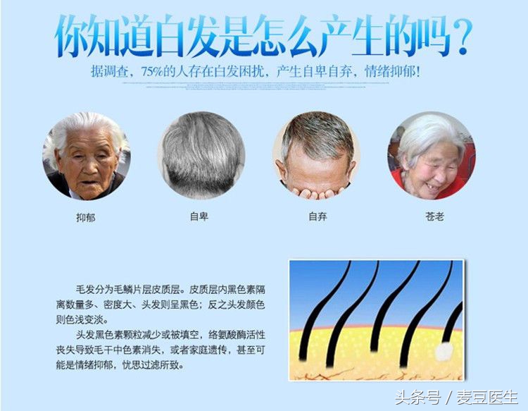 白发很多用什么方法乌黑头发,白发多不要慌教你改善白发问题