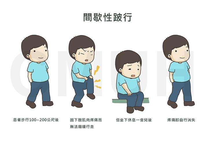 腰椎间盘突出右腿筋疼怎么锻炼,腰椎间盘突出腿疼康复锻炼单杠