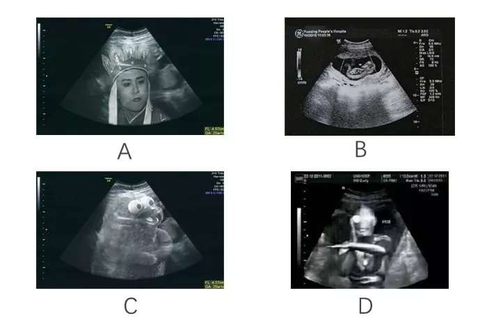 2018年普通高等妈妈育儿统一试卷——全国卷