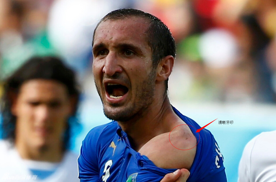 俄罗斯禁止宠物政策,足球世界杯禁止咬人吗