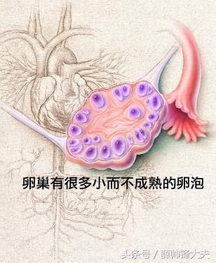 女性多囊专题,正视多囊别害怕
