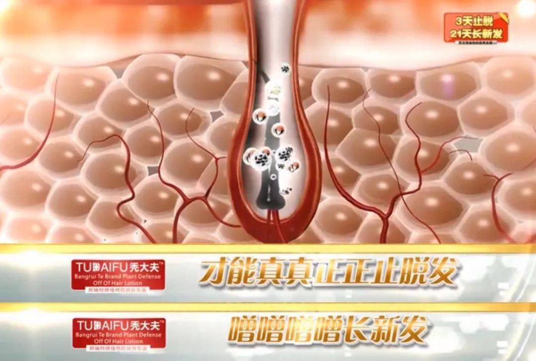 秃子坐诊生发专家,脱发专家教授