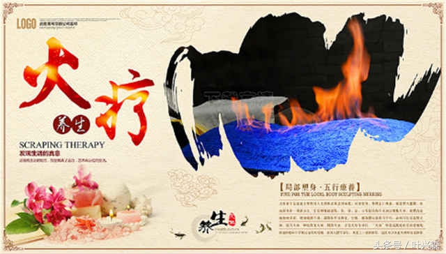 火疗在国外,外国火疗