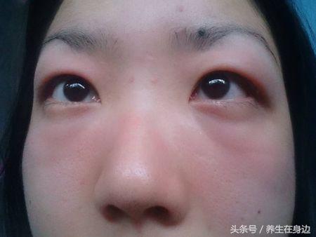 女人经期腰疼的厉害吃什么药好啊,女生经期腰疼吃什么缓解