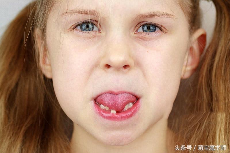 儿童缺少钙元素易患什么疾病,钙元素缺失吃什么