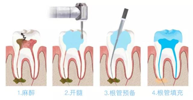 我们的目标是没有蛀牙广告原版,我们的目标是没有蛀牙