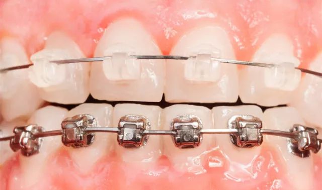 我们的目标是没有蛀牙广告原版,我们的目标是没有蛀牙