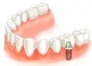 我们的目标是没有蛀牙广告原版,我们的目标是没有蛀牙
