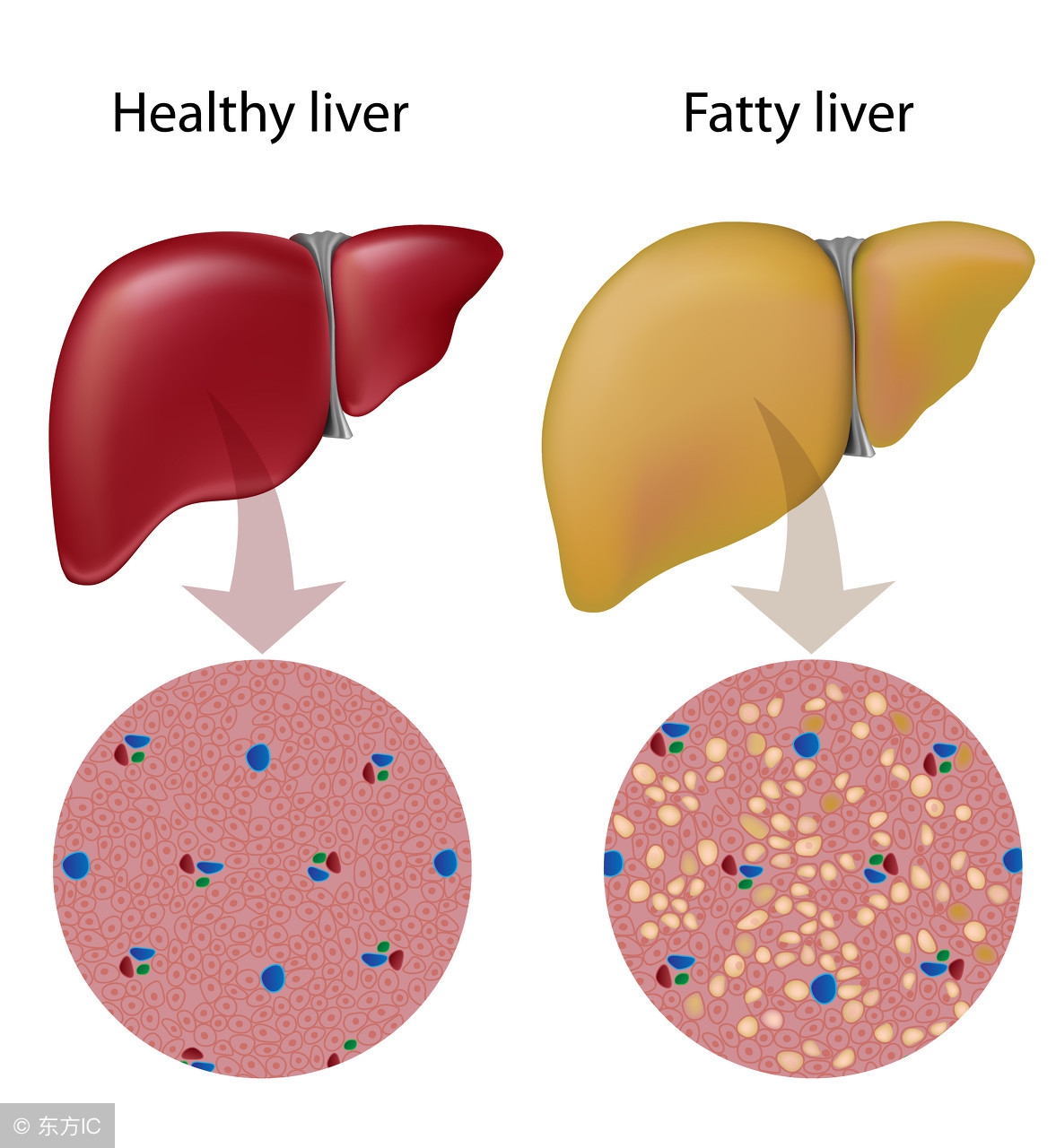 肝炎恶化会怎样,肝炎好转的征兆是什么