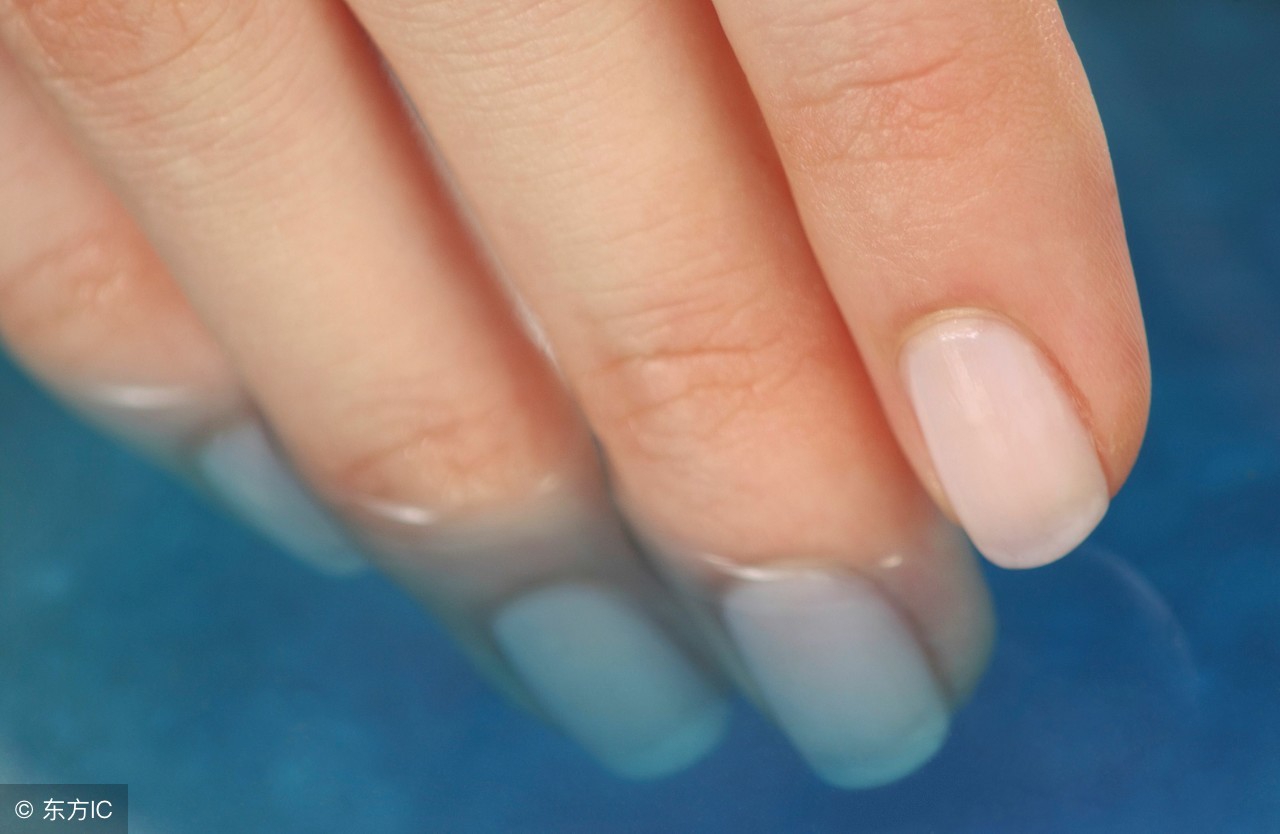 灰指甲应该多吃哪些食物，补充哪些营养素