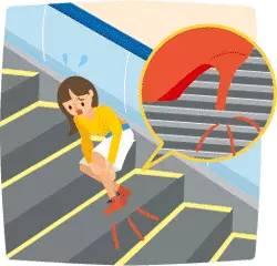 电梯安全装置图解,电梯安全使用图解及困梯自救