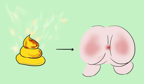 什么情况的便血需要就医,什么是便血尿血