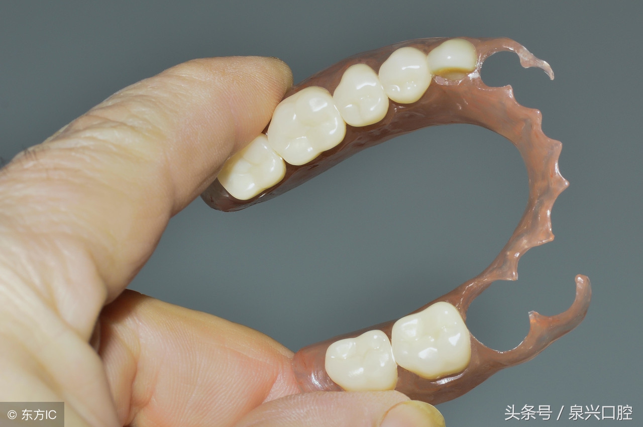 年轻人缺牙是选择种牙还是矫正牙,缺牙选择种牙还是戴牙套呢