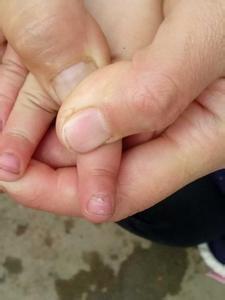 被a4纸划破是什么原因,为什么被a4纸划伤会更痛