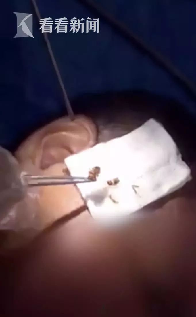 女子发烧42度,女子发烧39.7