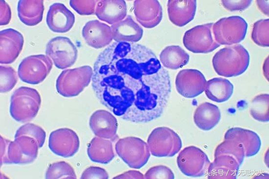 夏天是尿路感染的高发季，如何预防和治疗呢？