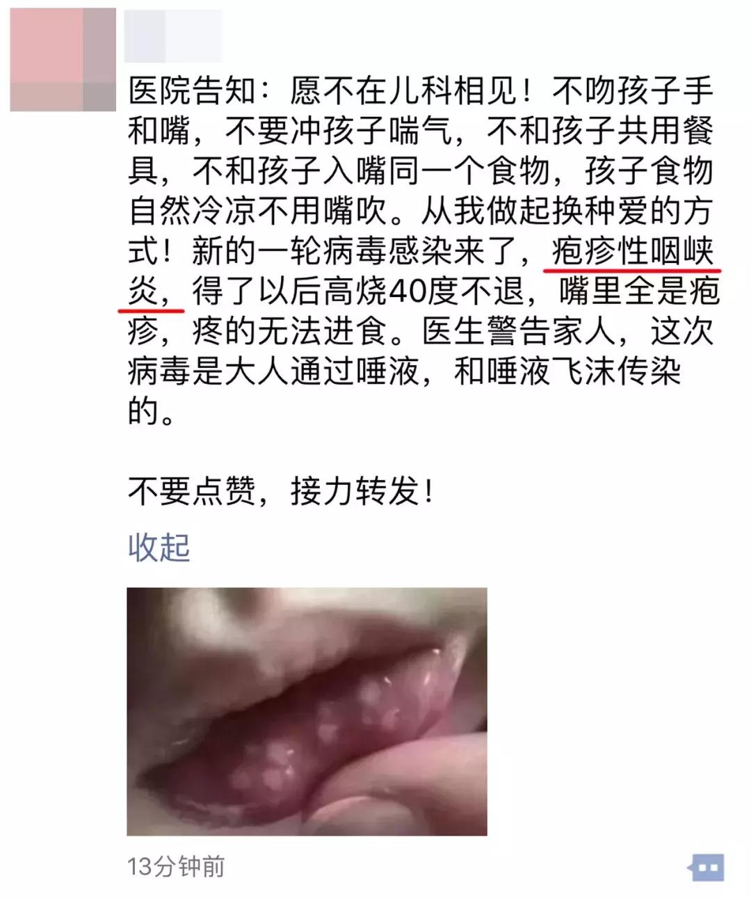 疱疹性咽峡炎身上会起疹子吗,幼儿园疱疹性咽峡炎停课标准