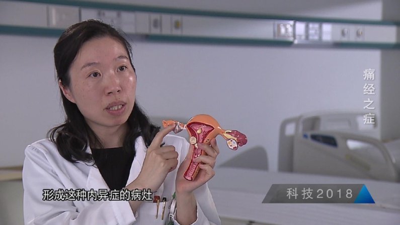 生完孩子痛经就好了是真的吗,生了孩子就不痛经是真的吗