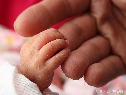 新生宝宝特有的生理现象,新生宝宝的常见现象