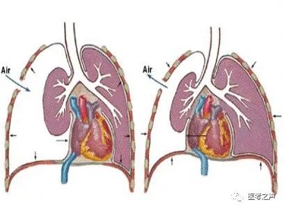 执医技能:X线阅片,全是套路,超简单